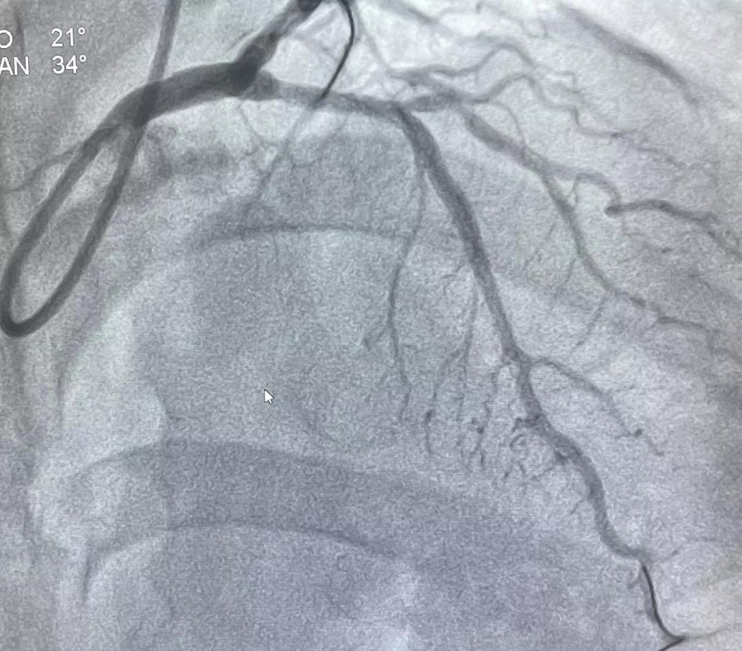 1638749070621050229.jpg 1638749070621050229.jpg