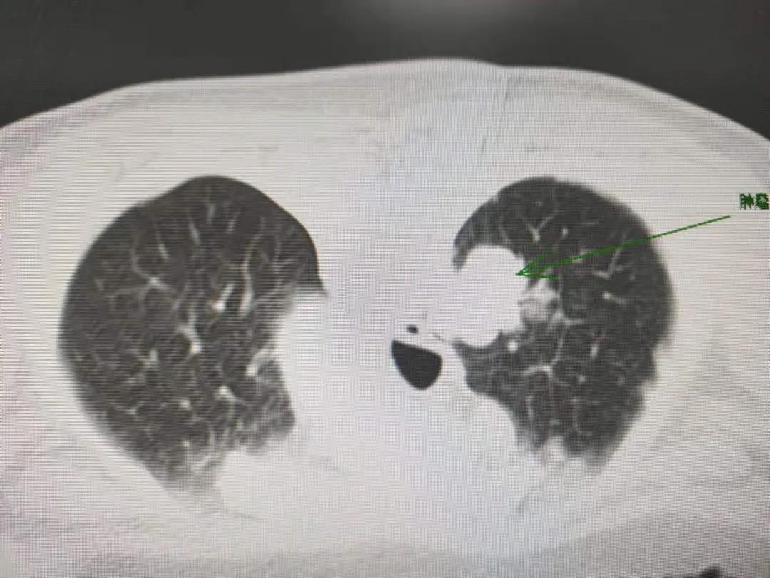 1638489632198006738.jpg 1638489632198006738.jpg