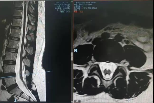 1639615910683067997.jpg 1639615910683067997.jpg