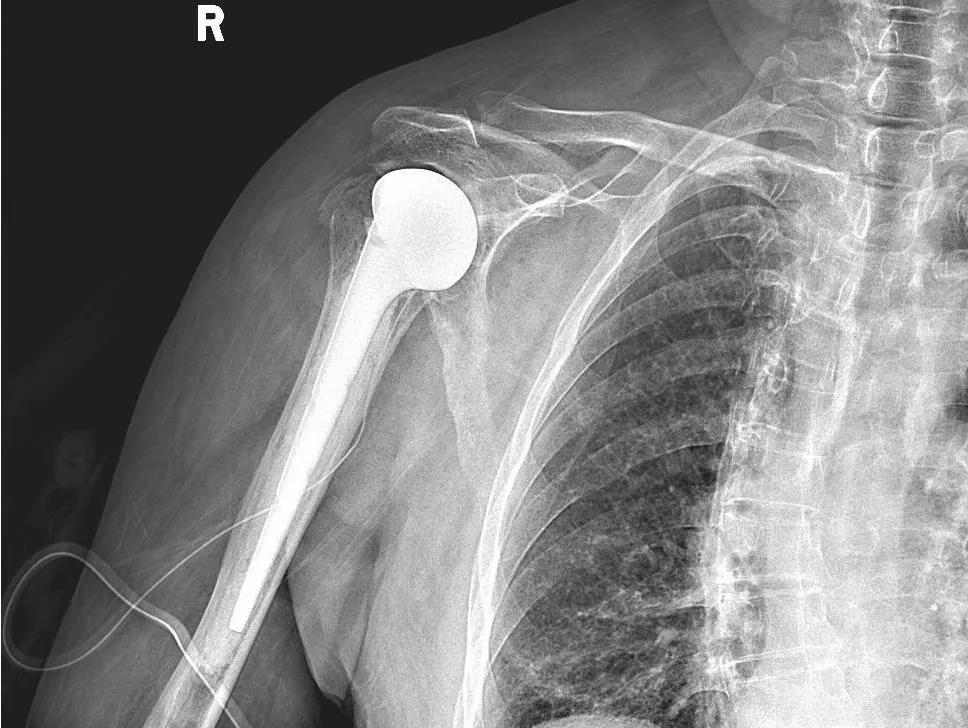 1644463178424055365.jpg 1644463178424055365.jpg