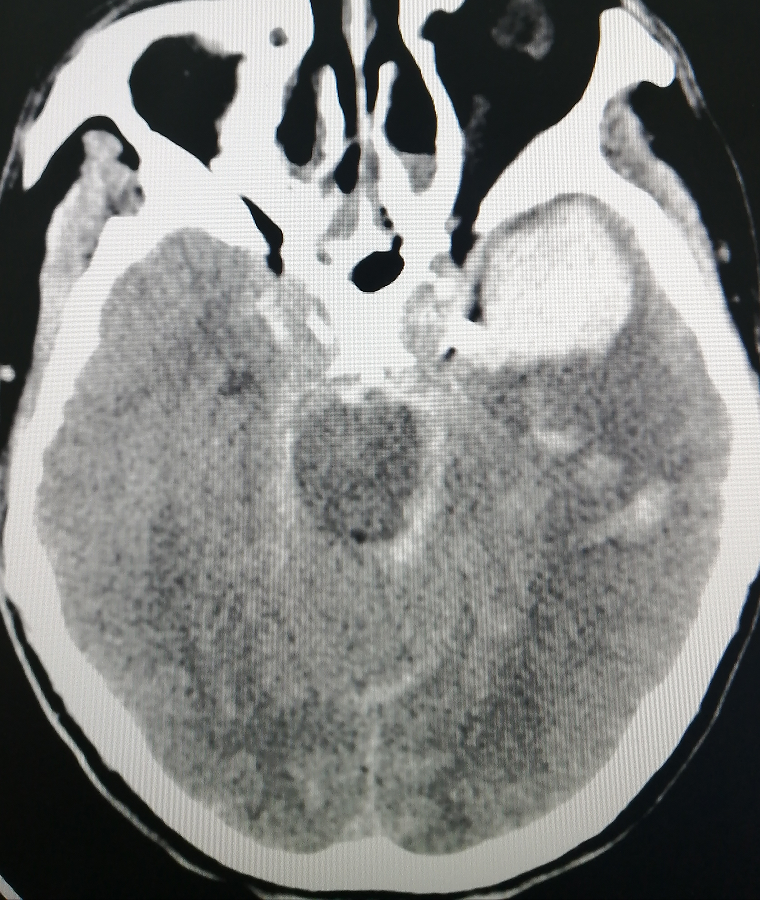 1647248033408091029.png 1647248033408091029.png