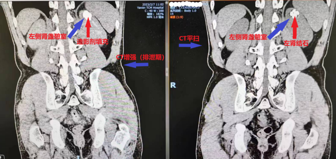 1680761955212017169.png 1680761955212017169.png