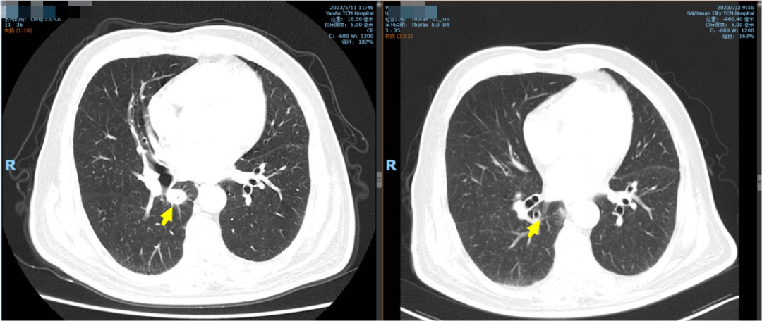 1693267808129013107.png 1693267808129013107.png